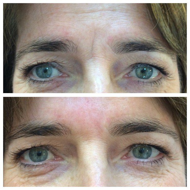 17265818_918831854920252_5233741911616913408_n